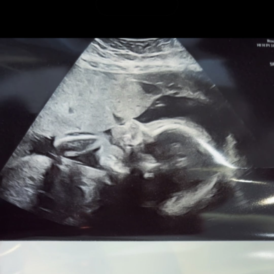 Photo shared by Lorraine for their Babylist baby registry.