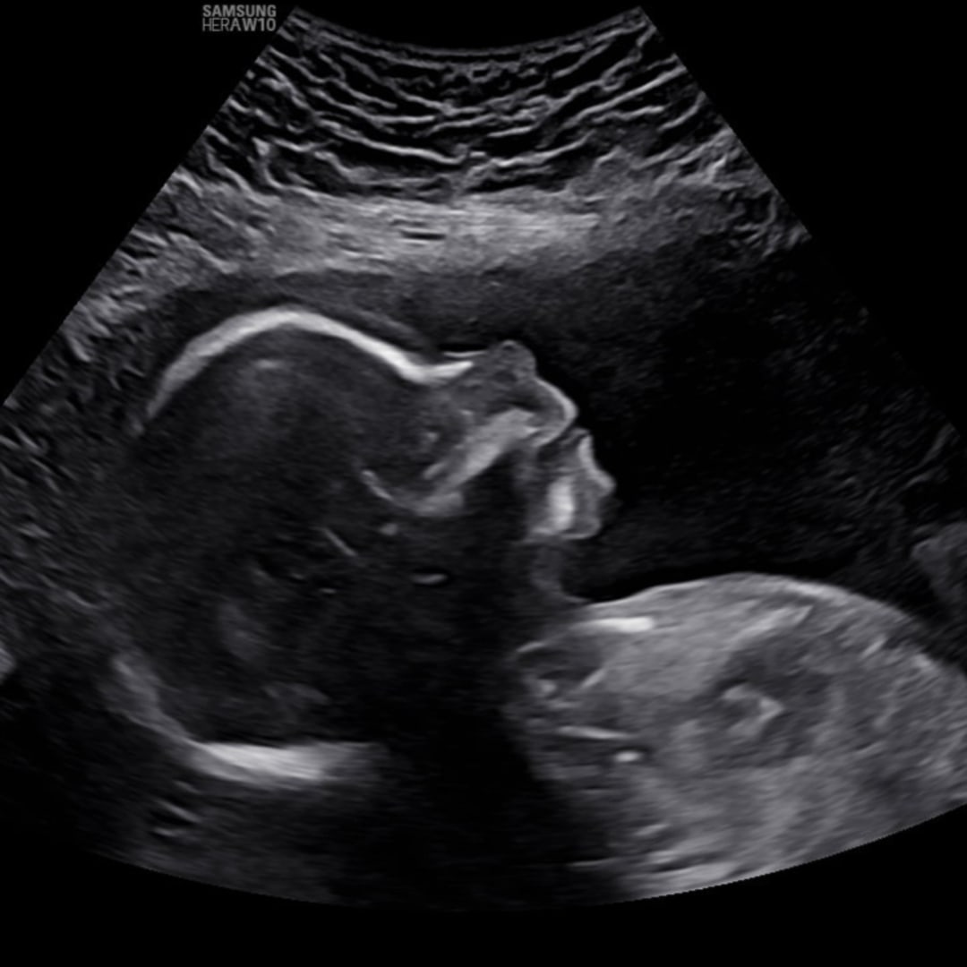 Photo shared by Aubrey for their Babylist baby registry.