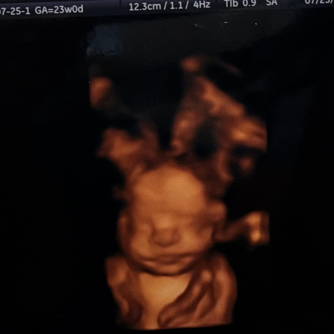 Photo shared by Alyssa for their Babylist baby registry.