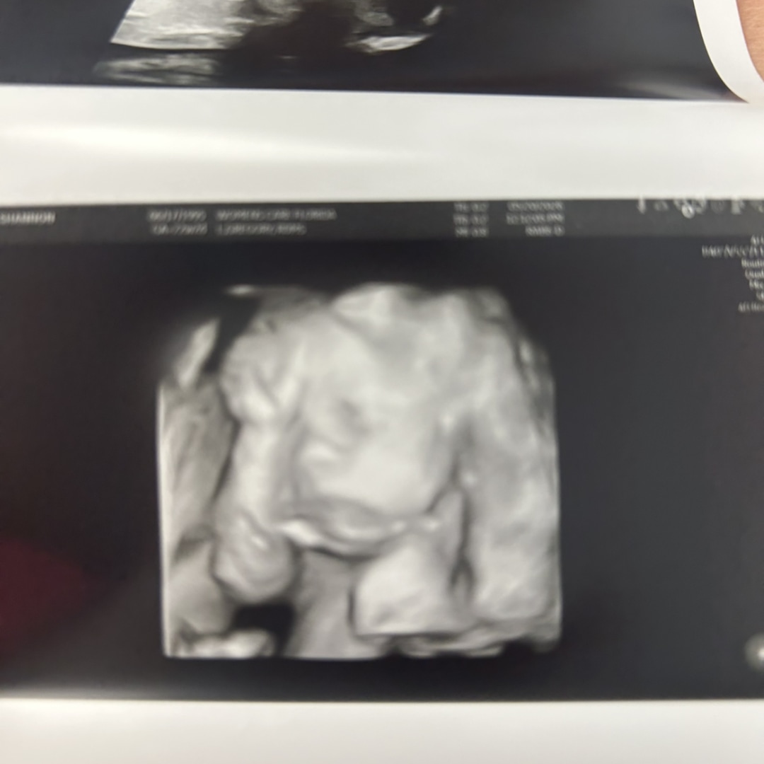 Photo shared by Shannon for their Babylist baby registry.