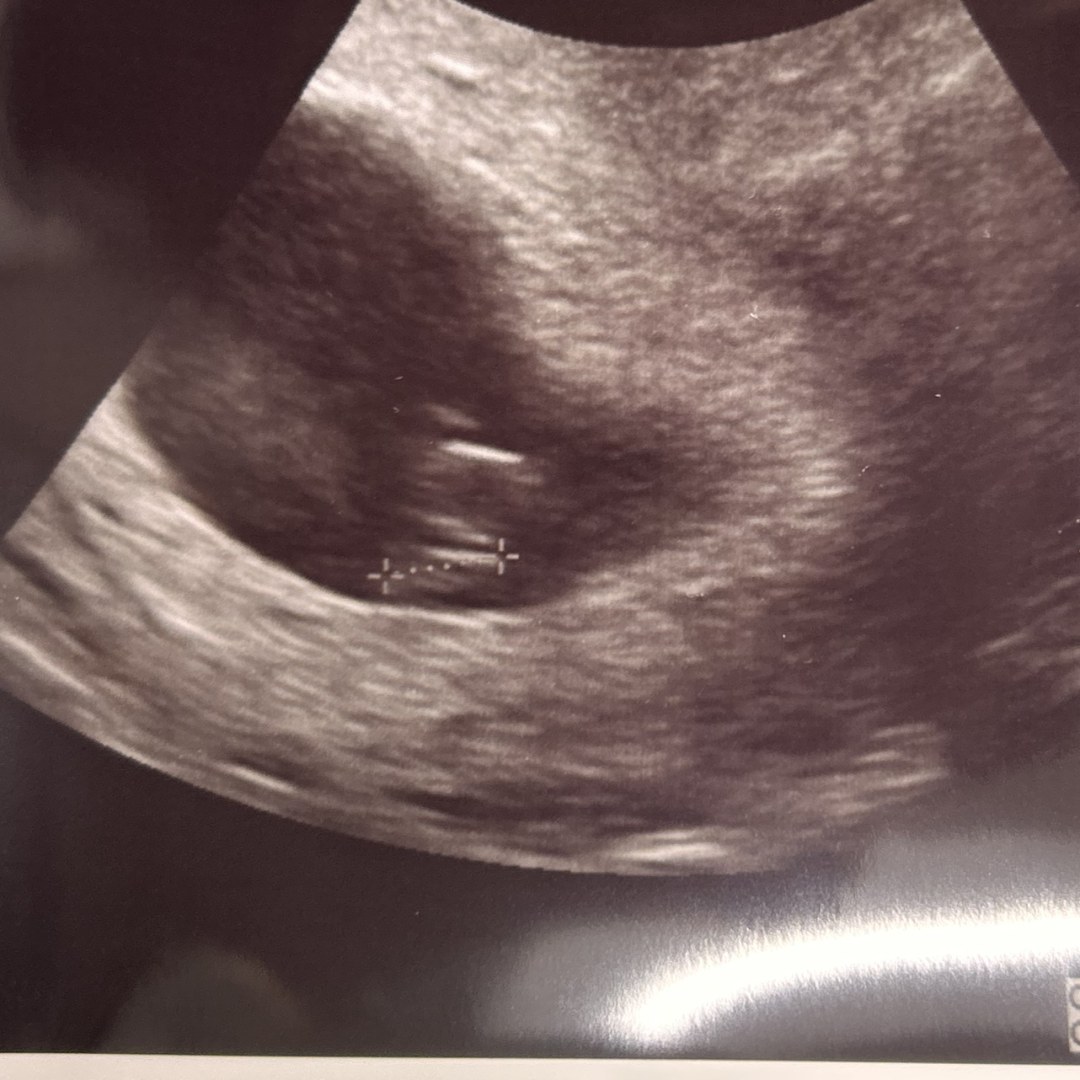 Photo shared by Linda for their Babylist baby registry.