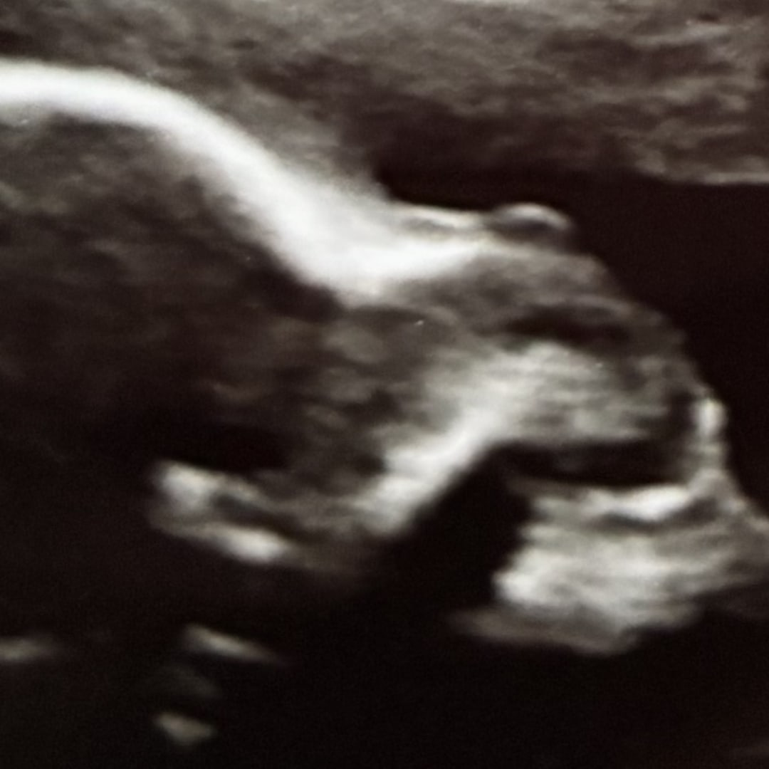 Photo shared by Bridey for their Babylist baby registry.