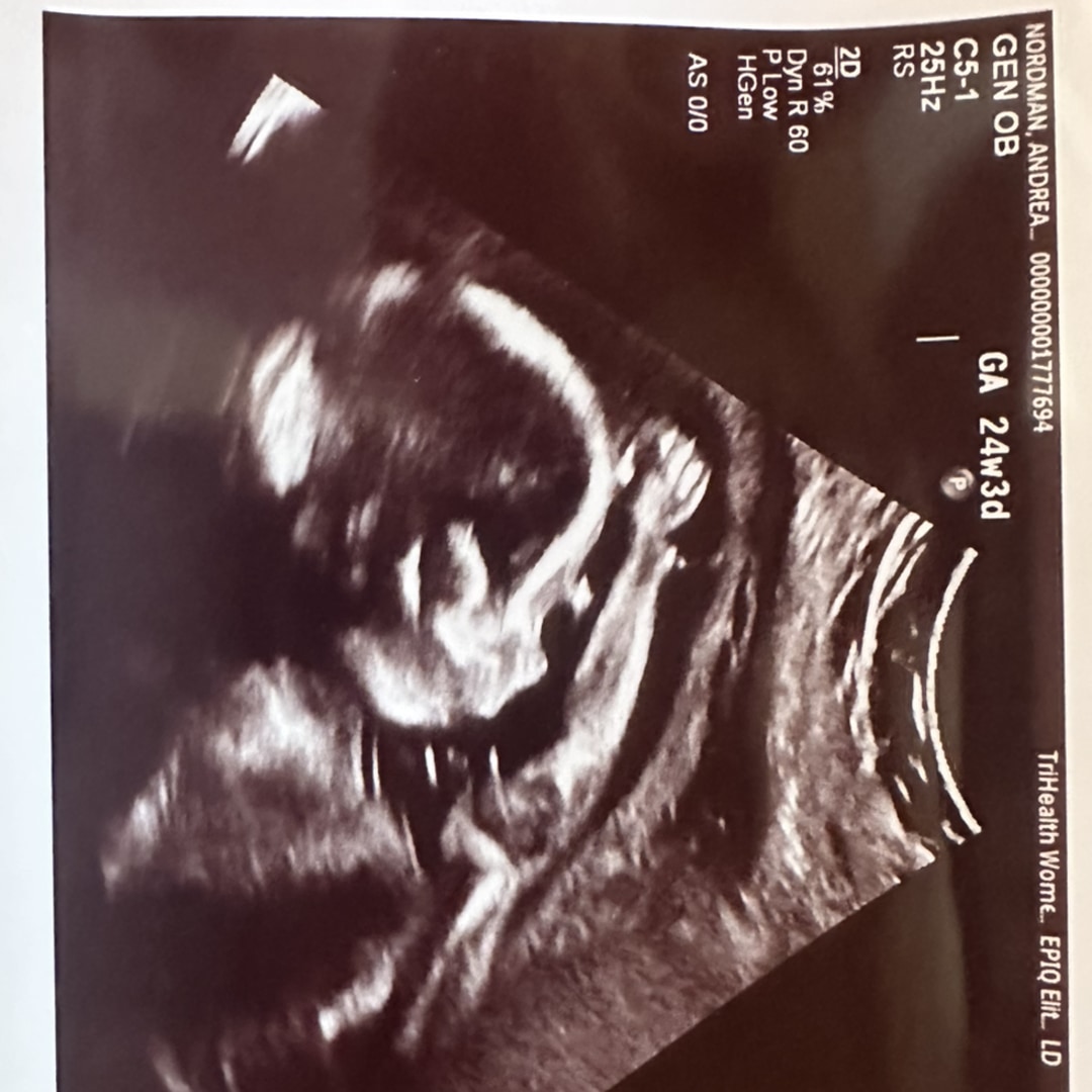 Photo shared by Andi for their Babylist baby registry.