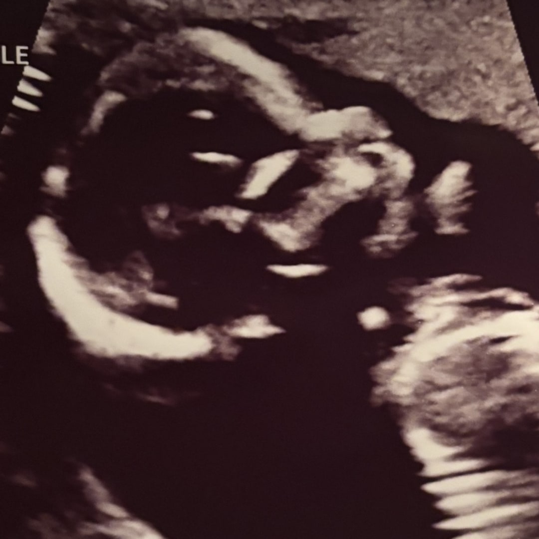 Photo shared by Jade for their Babylist baby registry.
