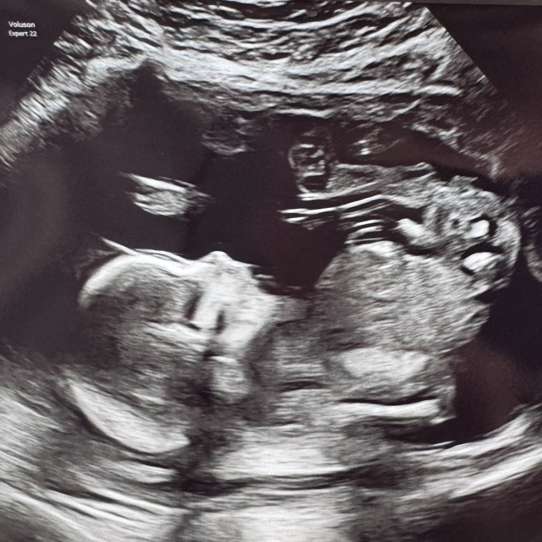 Photo shared by Caroline for their Babylist baby registry.