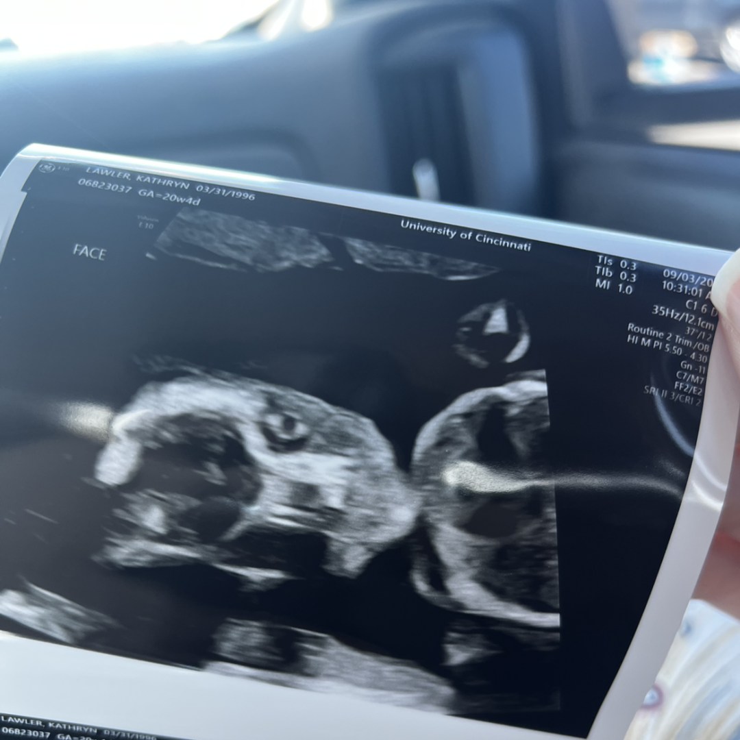 Photo shared by Kathryn for their Babylist baby registry.