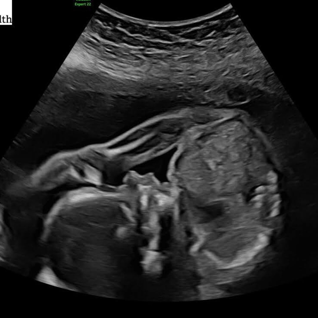 Photo shared by Hannah for their Babylist baby registry.