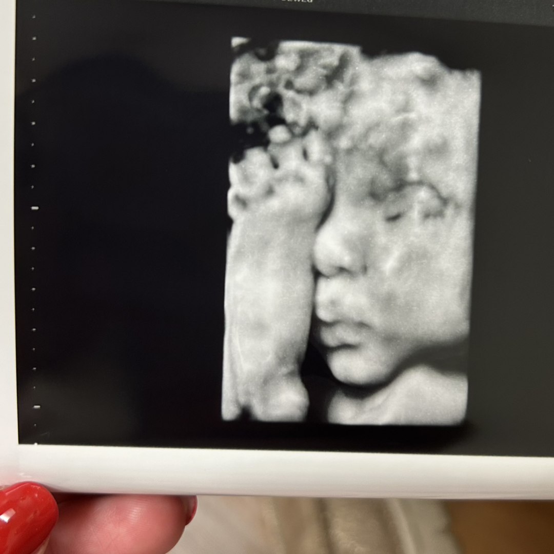 Photo shared by Rachel for their Babylist baby registry.