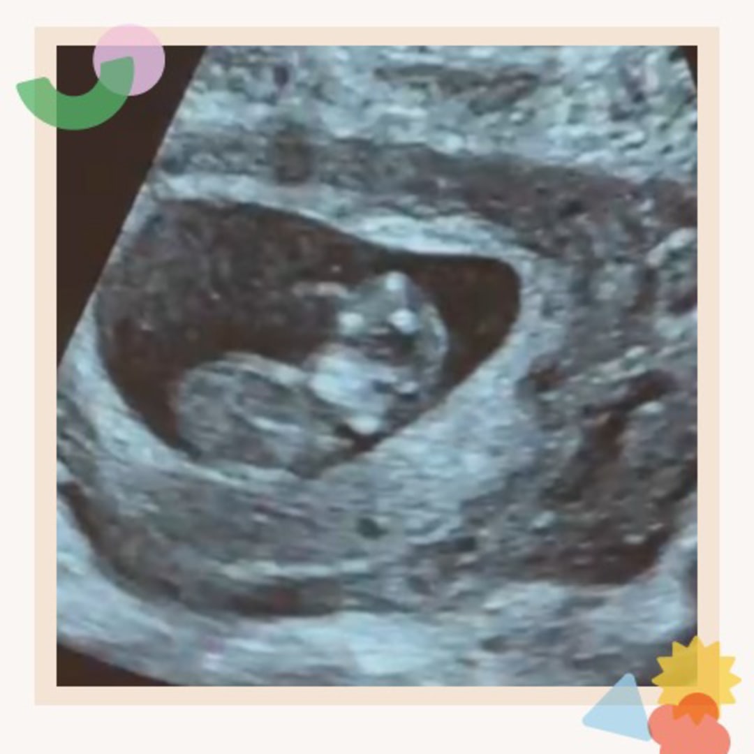 Photo shared by Katheryne P. for their Babylist baby registry.