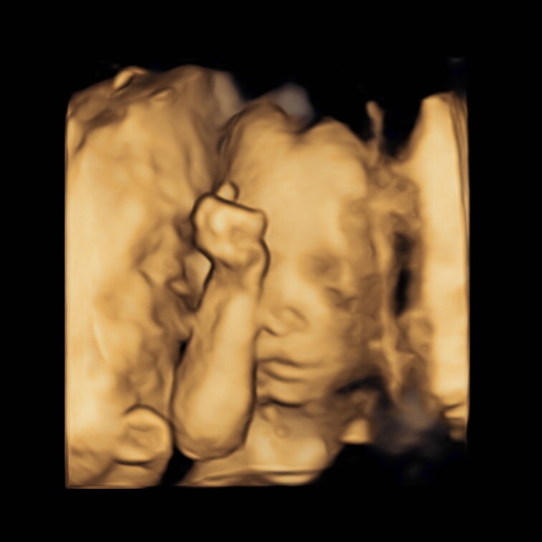 Photo shared by Andrea for their Babylist baby registry.