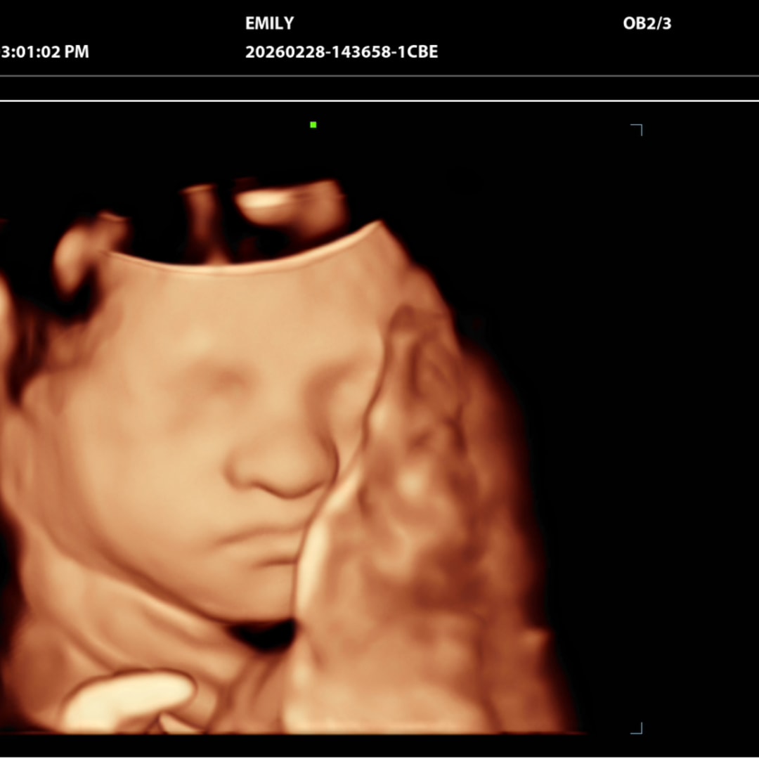 Photo shared by Emily for their Babylist baby registry.