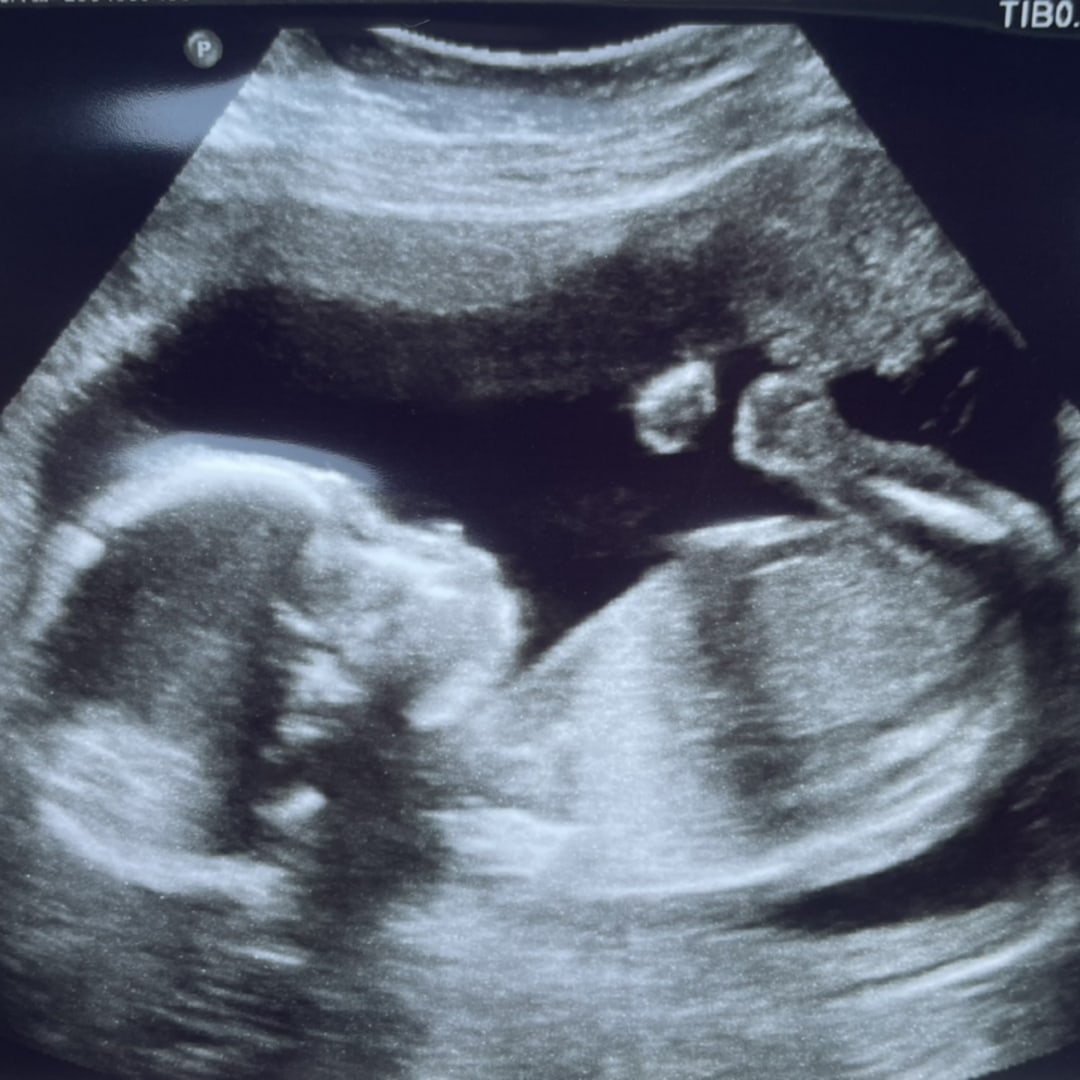 Photo shared by Jessica for their Babylist baby registry.