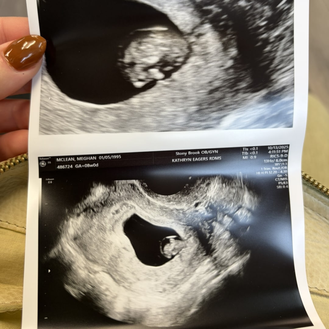 Photo shared by Meg for their Babylist baby registry.