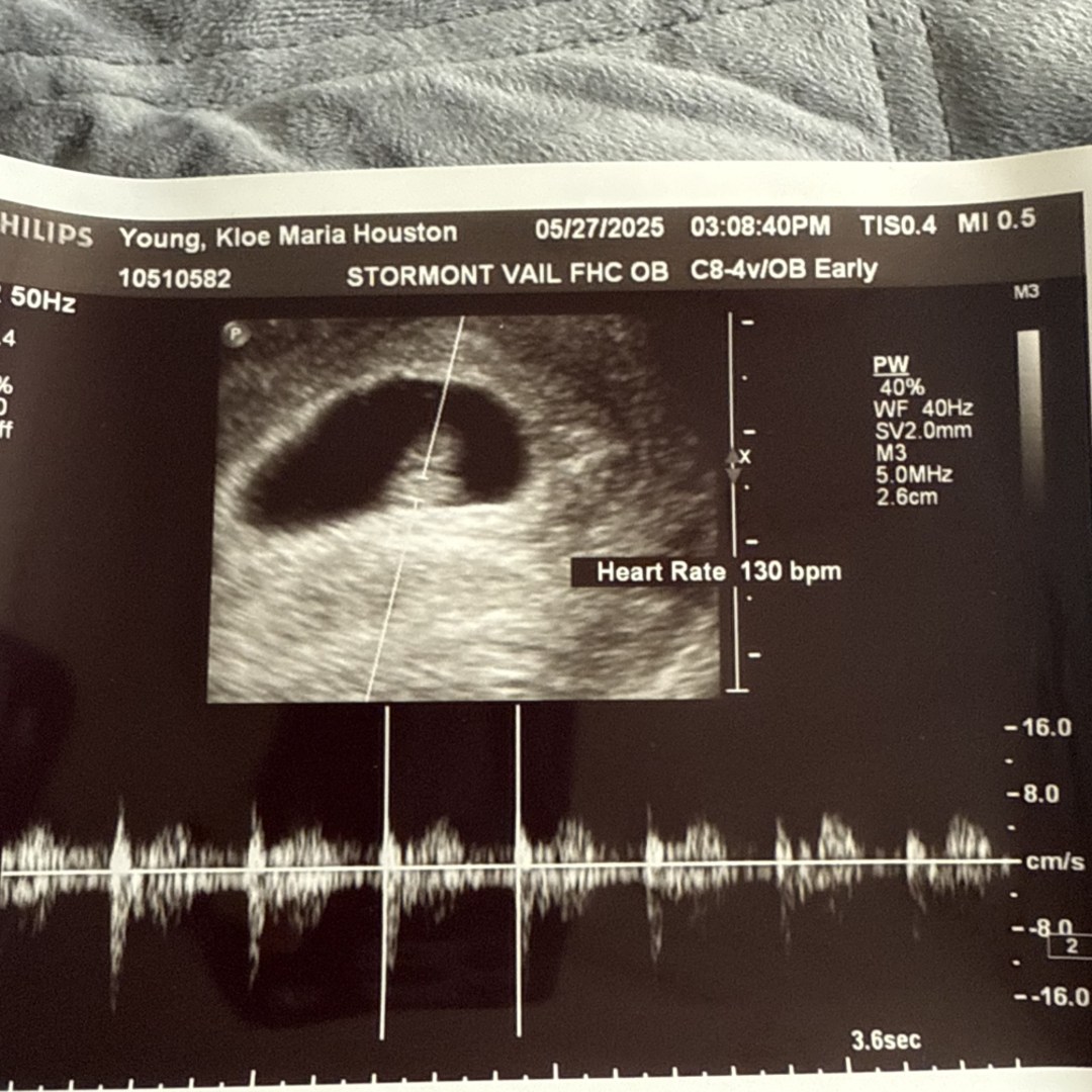 Photo shared by Kloe for their Babylist baby registry.