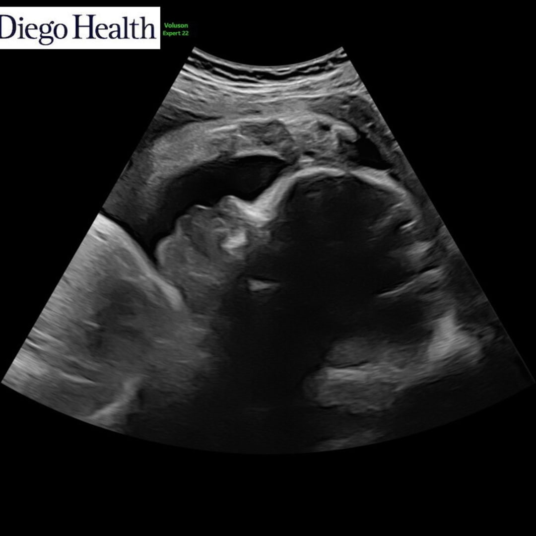 Photo shared by Erica for their Babylist baby registry.