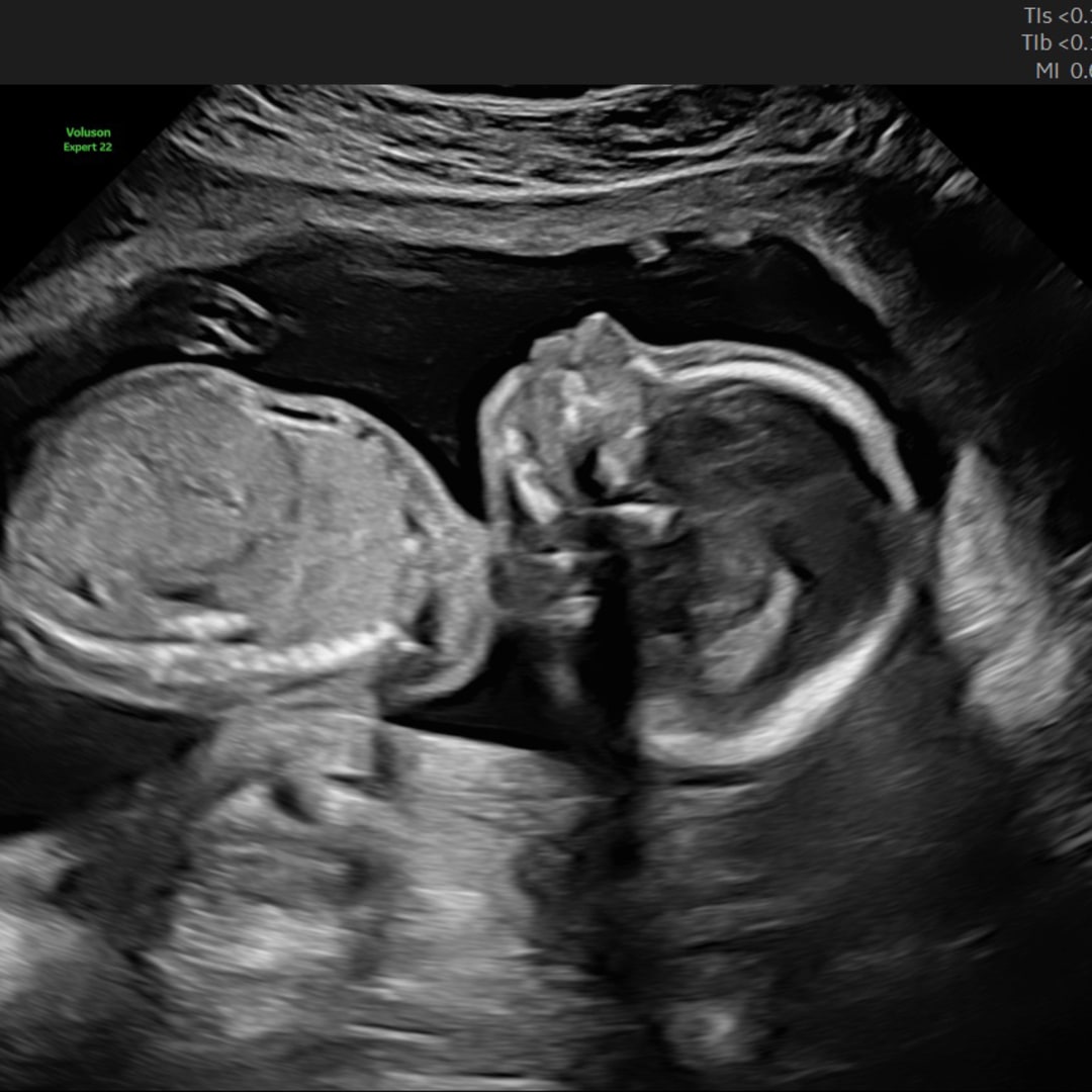 Photo shared by Hannah for their Babylist baby registry.