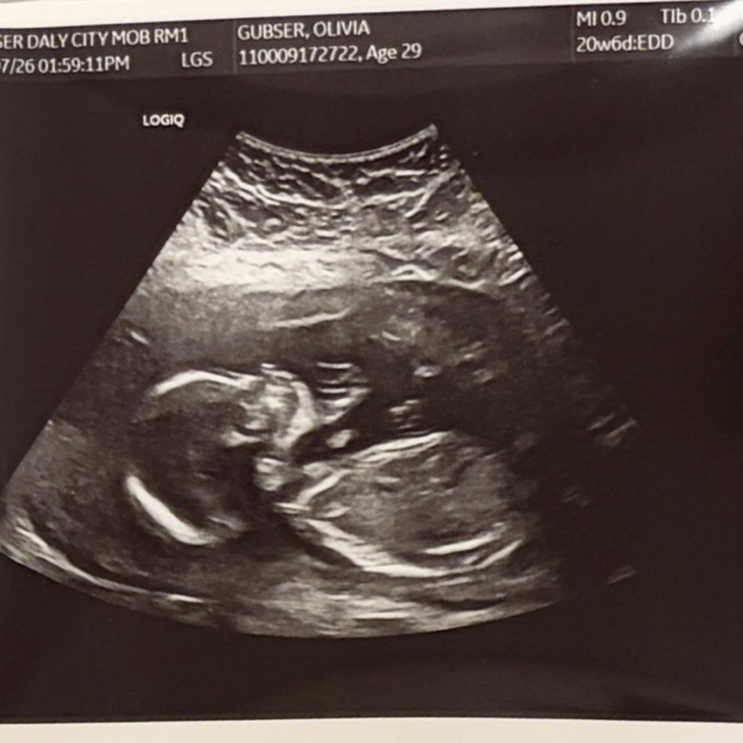 Photo shared by Olivia for their Babylist baby registry.