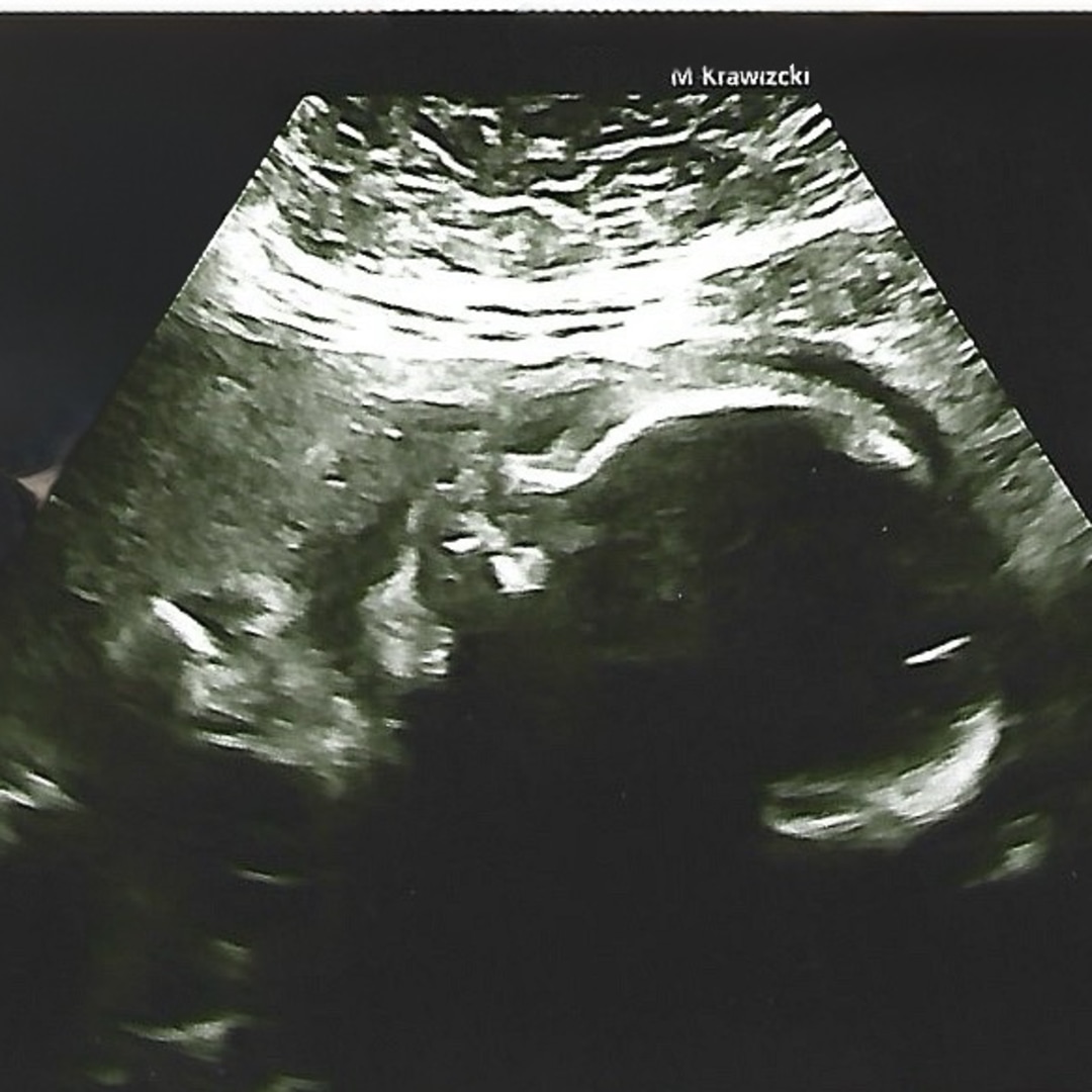 Photo shared by Whitney for their Babylist baby registry.