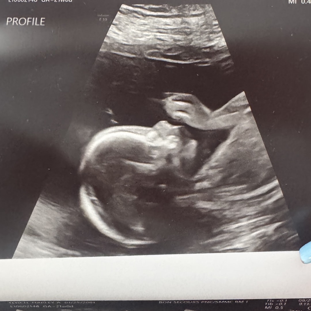 Photo shared by Harley for their Babylist baby registry.