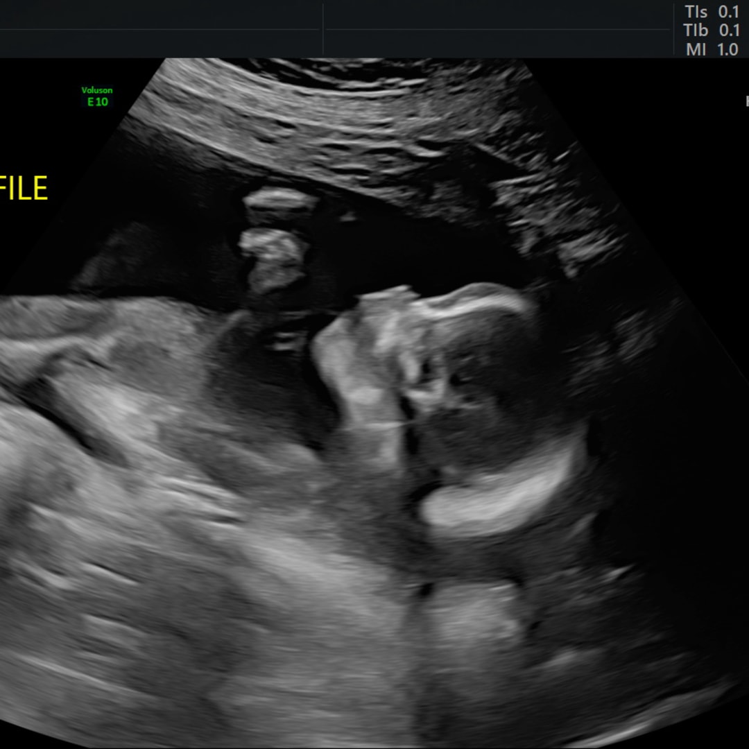 Photo shared by Eryka for their Babylist baby registry.