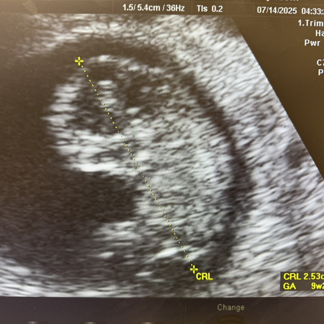 Photo shared by Sofia for their Babylist baby registry.