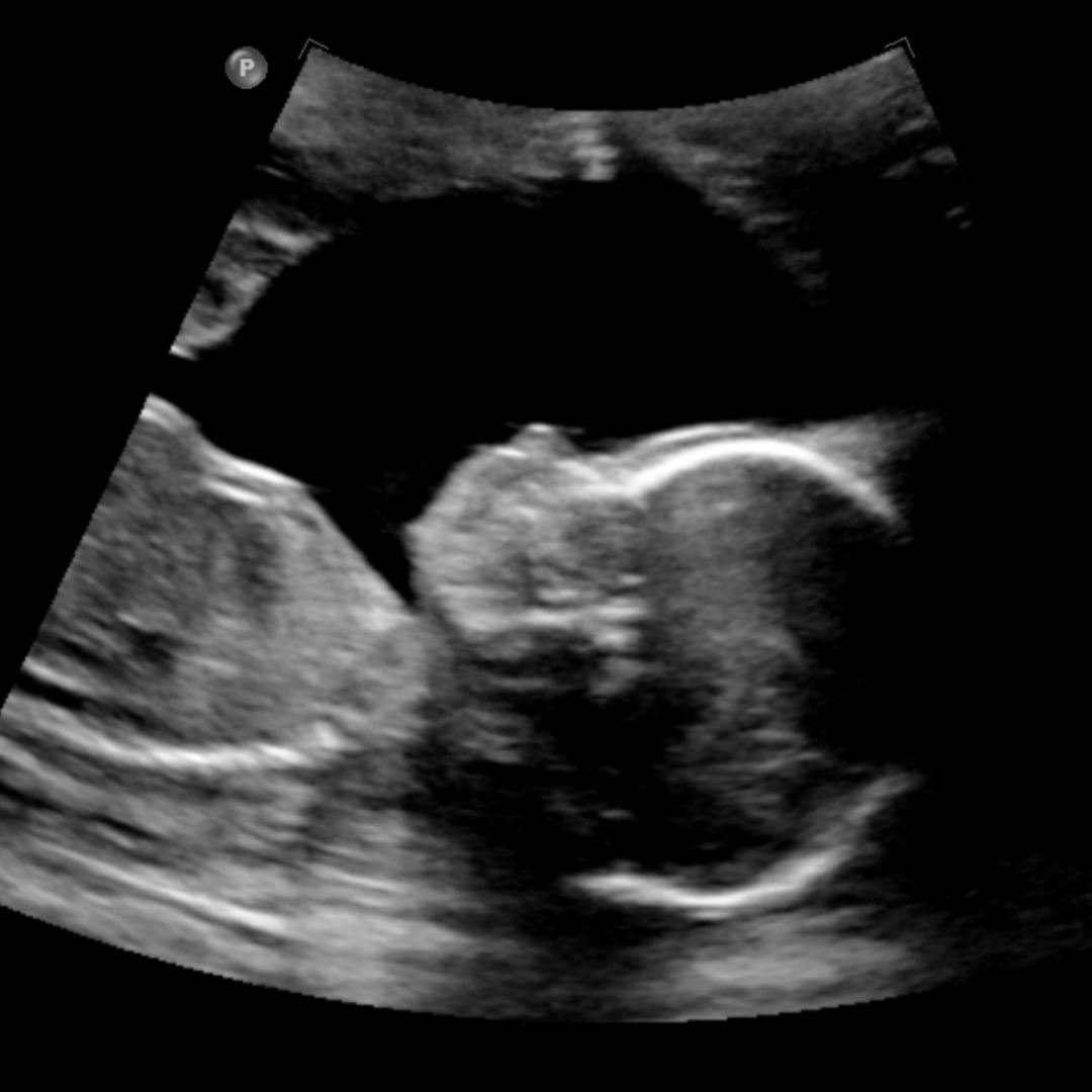 Photo shared by Alice for their Babylist baby registry.