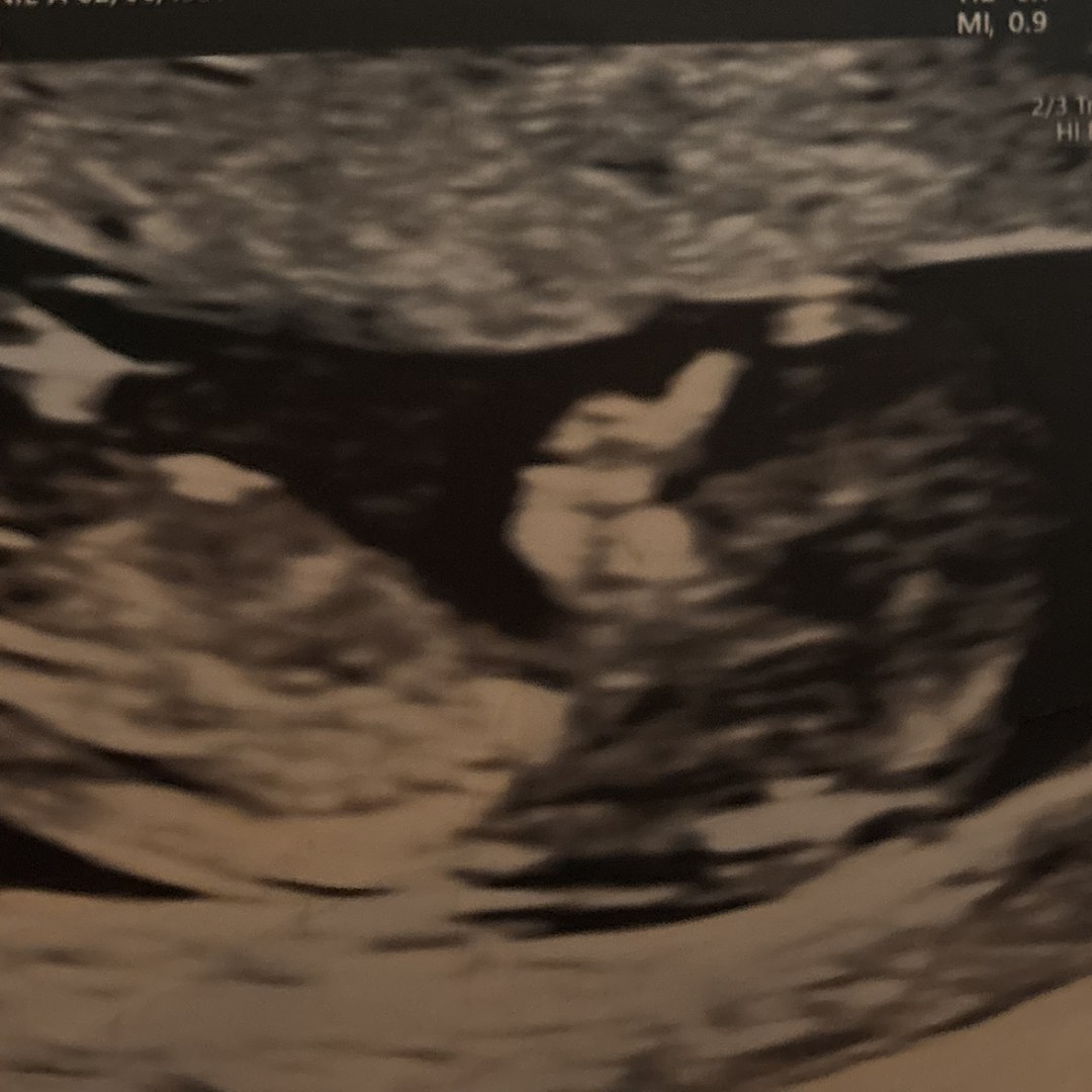 Photo shared by Stephanie for their Babylist baby registry.