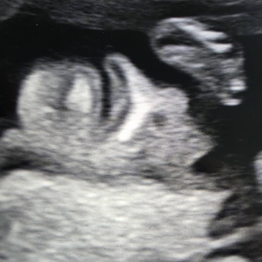 Photo shared by Paige for their Babylist baby registry.