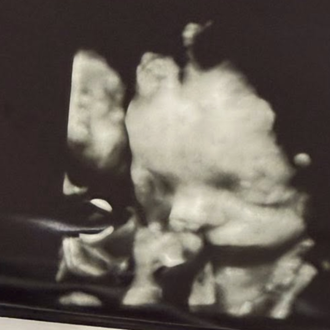 Photo shared by Emma for their Babylist baby registry.