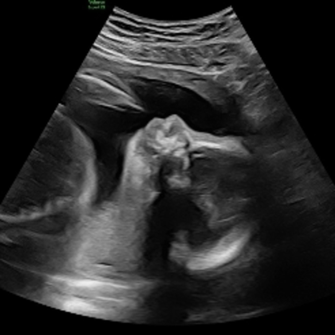 Photo shared by Xamarah for their Babylist baby registry.