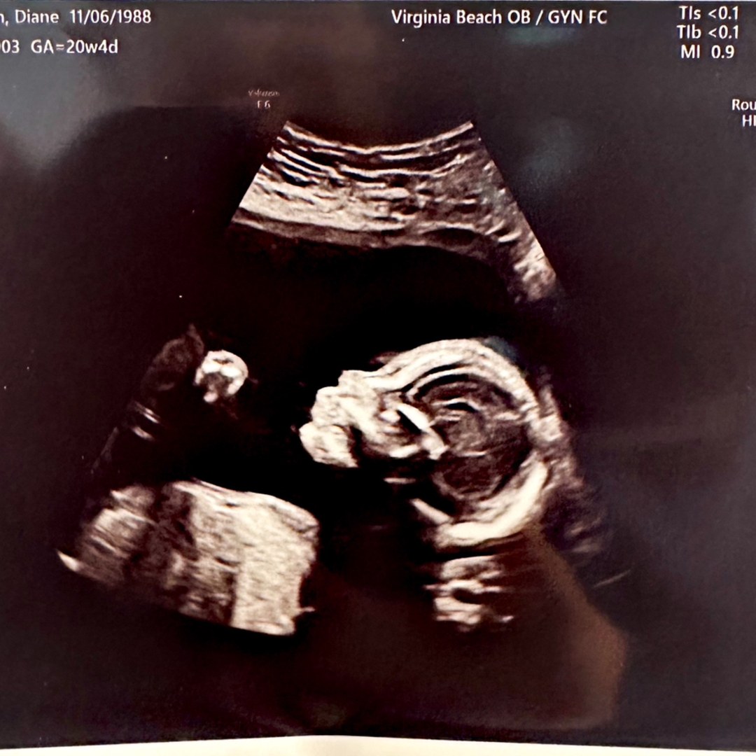 Photo shared by Diane for their Babylist baby registry.