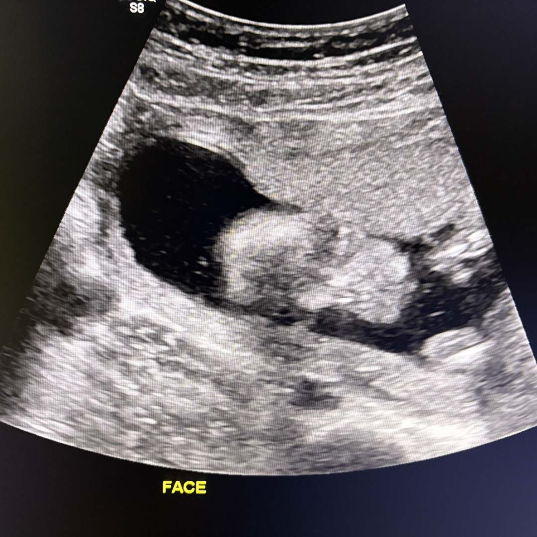 Photo shared by Hannah for their Babylist baby registry.