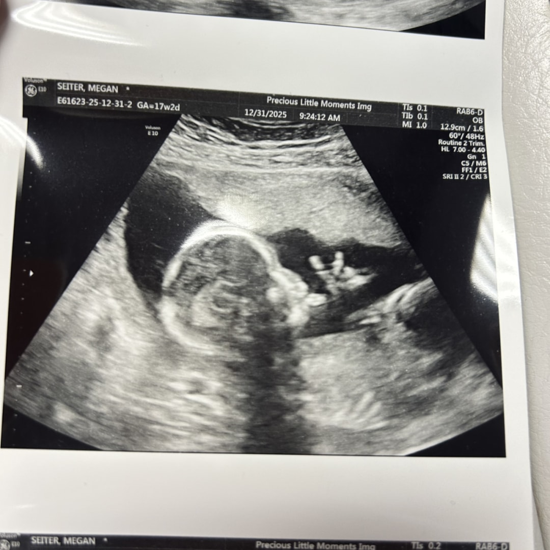 Photo shared by Megan for their Babylist baby registry.