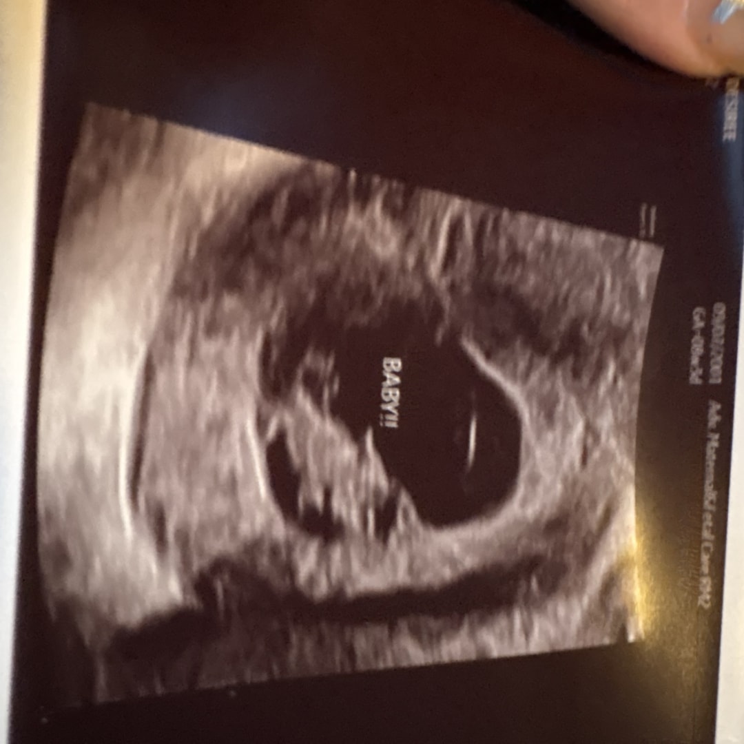 Photo shared by Desiree for their Babylist baby registry.