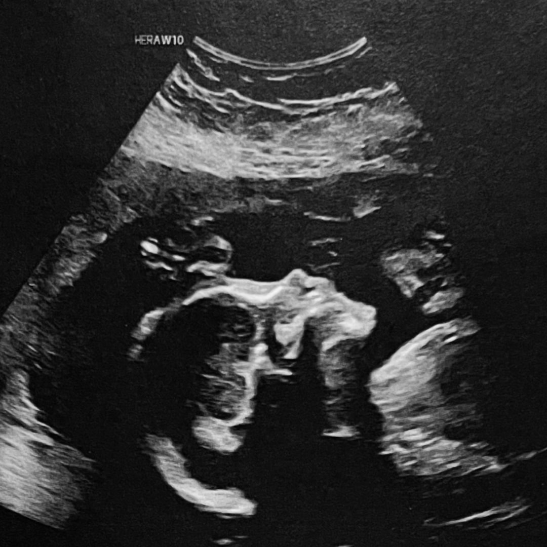 Photo shared by Ainsley for their Babylist baby registry.