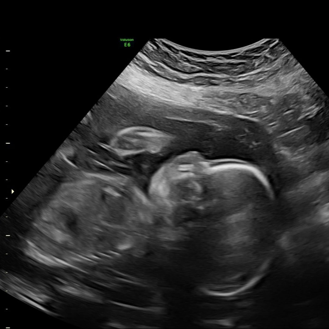 Photo shared by Abigail for their Babylist baby registry.