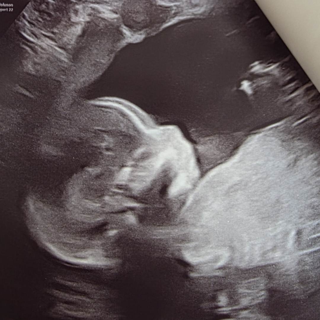 Photo shared by Rachel for their Babylist baby registry.