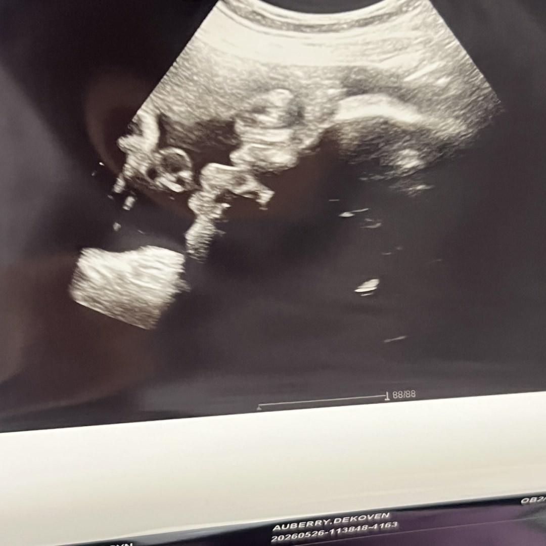 Photo shared by Dekoven for their Babylist baby registry.