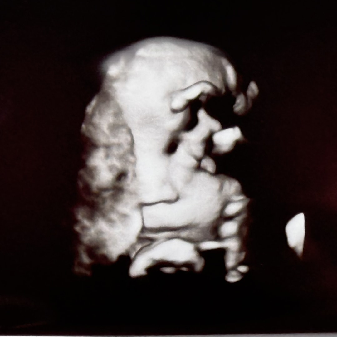 Photo shared by Lauren for their Babylist baby registry.