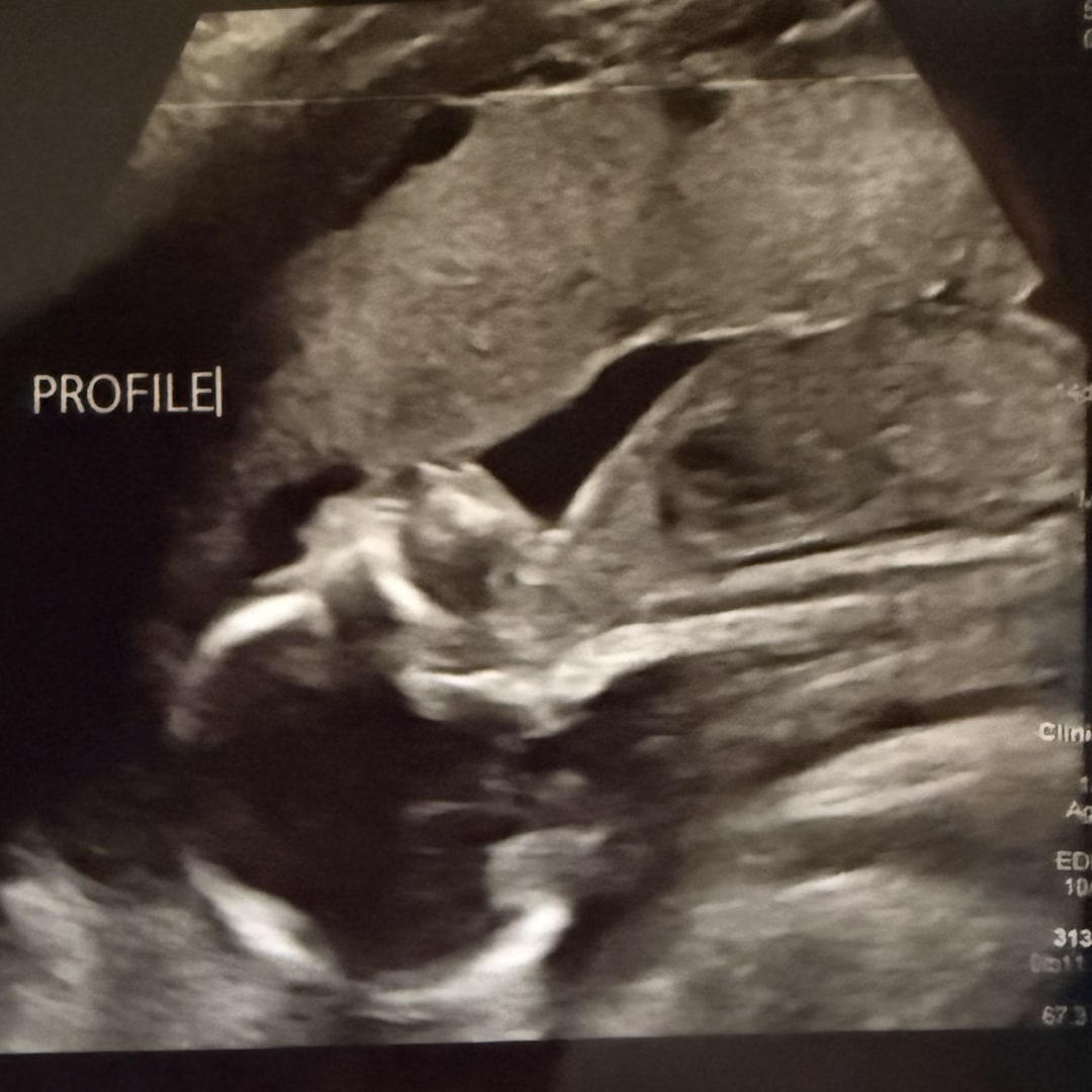Photo shared by Lydia for their Babylist baby registry.