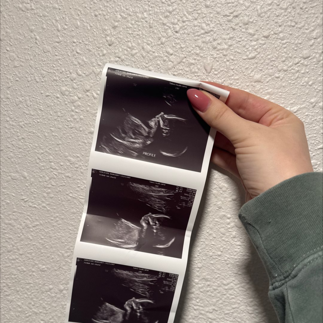 Photo shared by Maggie for their Babylist baby registry.