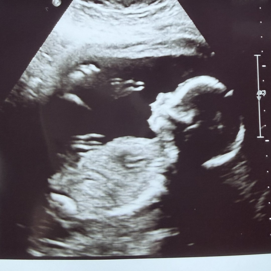Photo shared by Brittany for their Babylist baby registry.