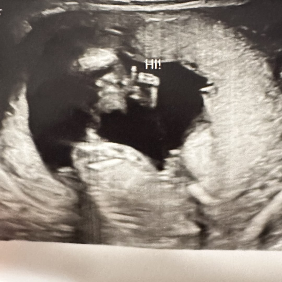 Photo shared by Chivu for their Babylist baby registry.