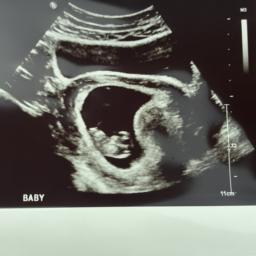 Photo shared by Allison for their Babylist baby registry.