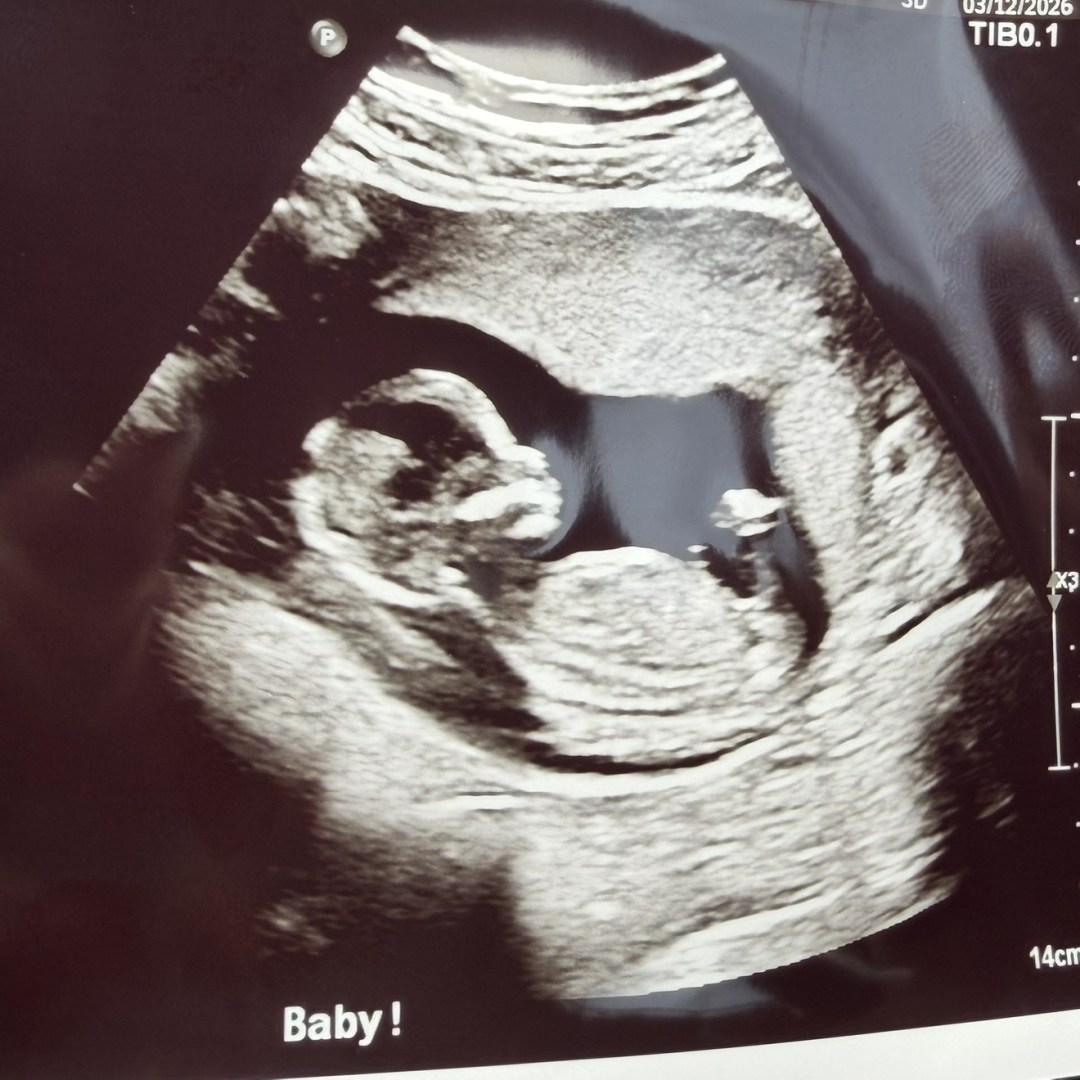 Photo shared by Yariannet for their Babylist baby registry.