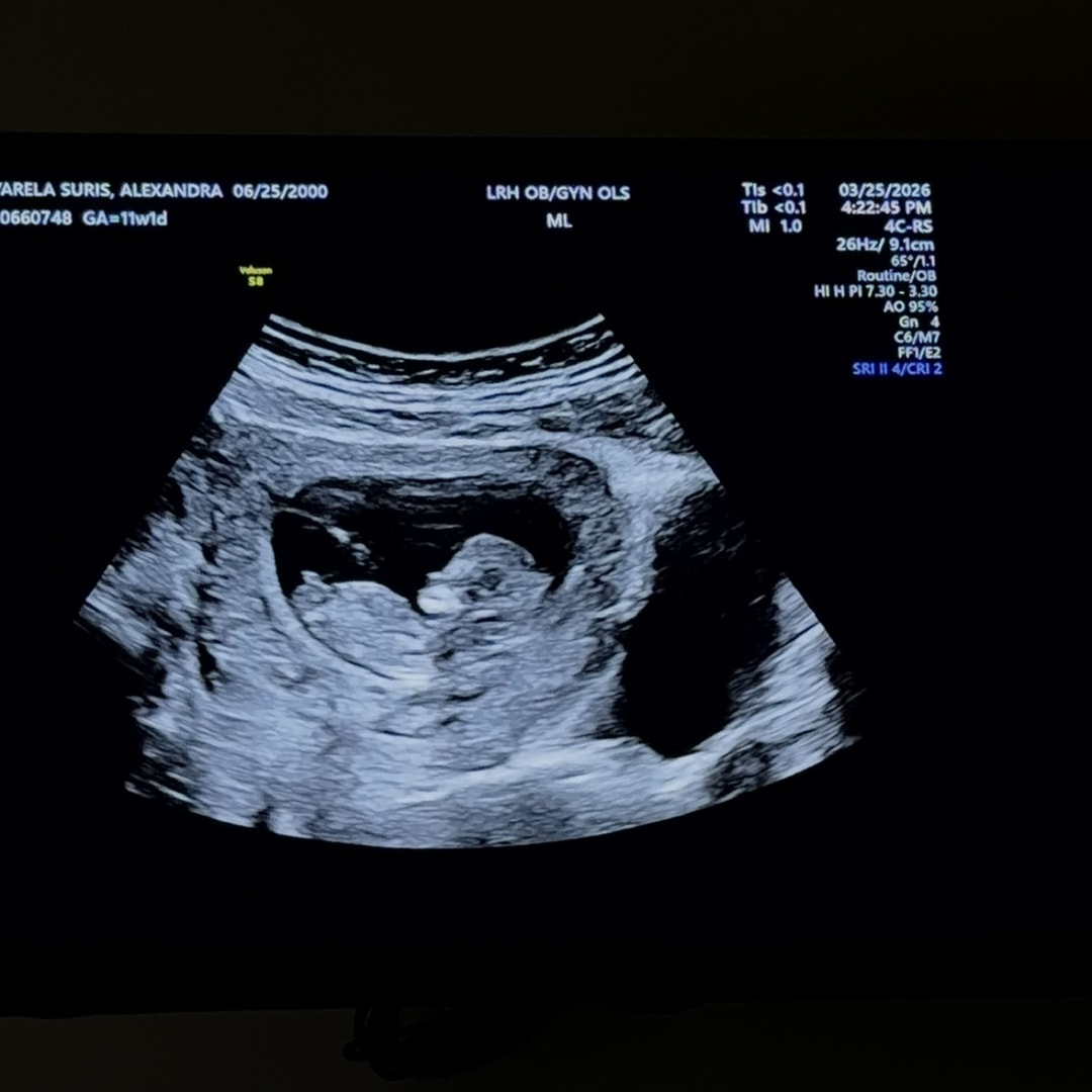 Photo shared by Alex for their Babylist baby registry.