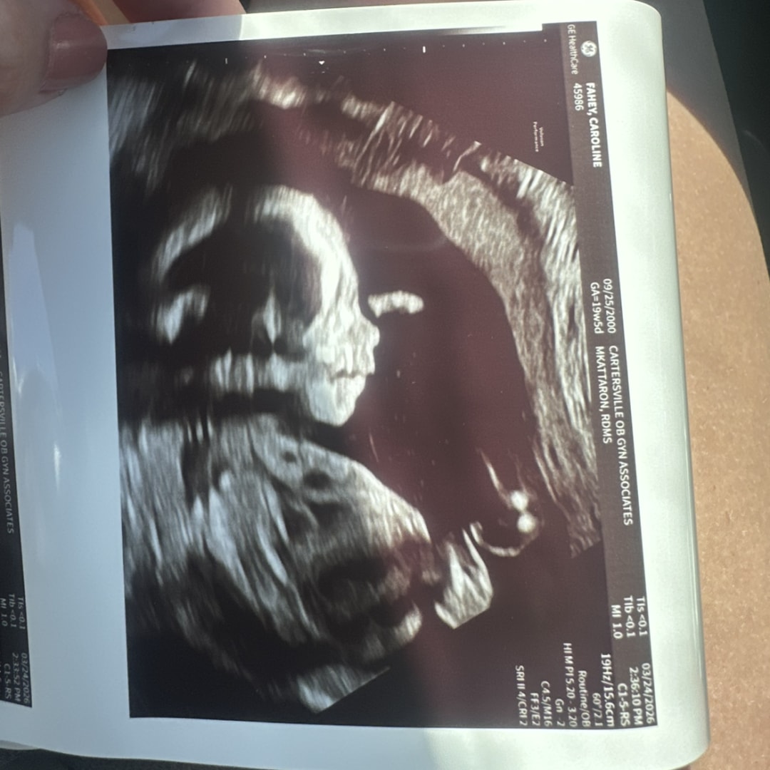 Photo shared by Caroline for their Babylist baby registry.