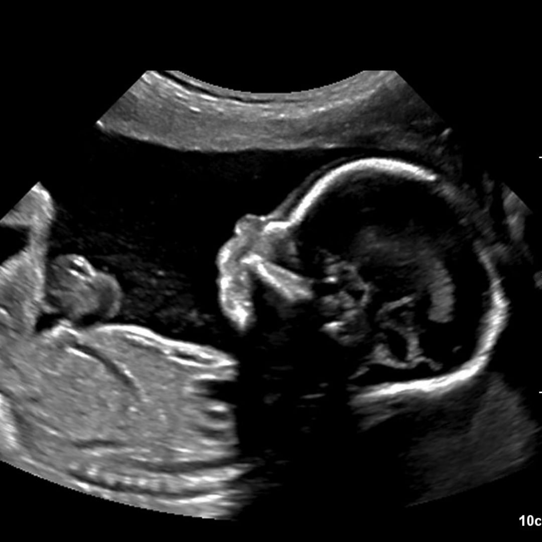 Photo shared by Cassidy for their Babylist baby registry.