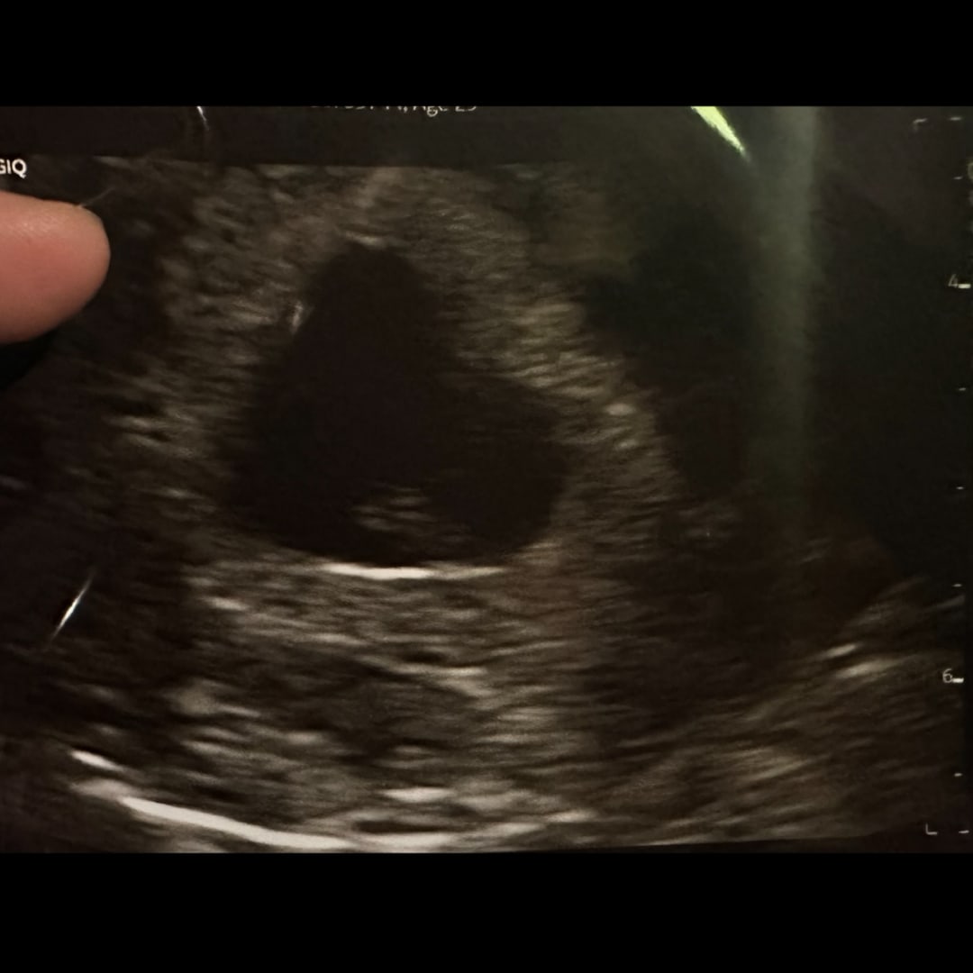 Photo shared by Rose for their Babylist baby registry.
