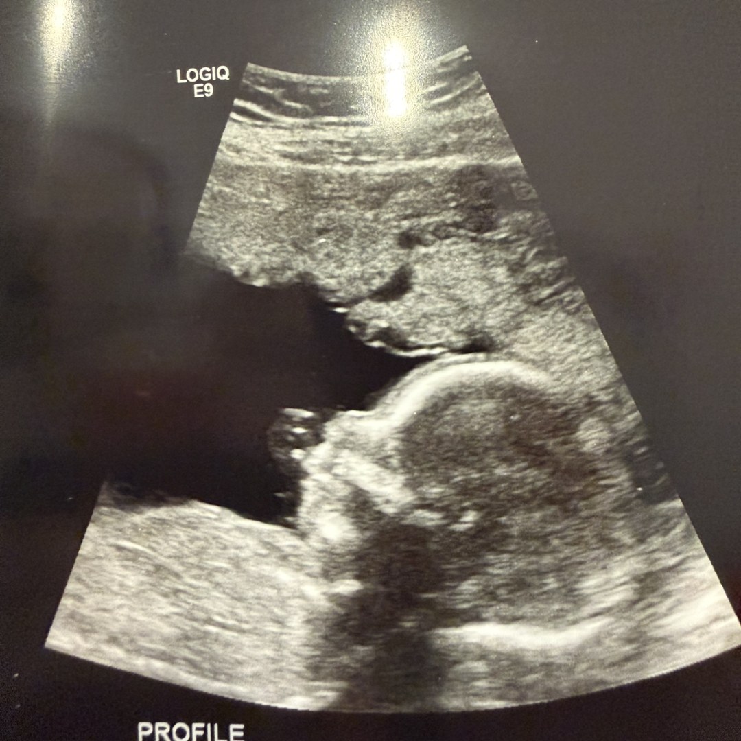 Photo shared by Brittney for their Babylist baby registry.